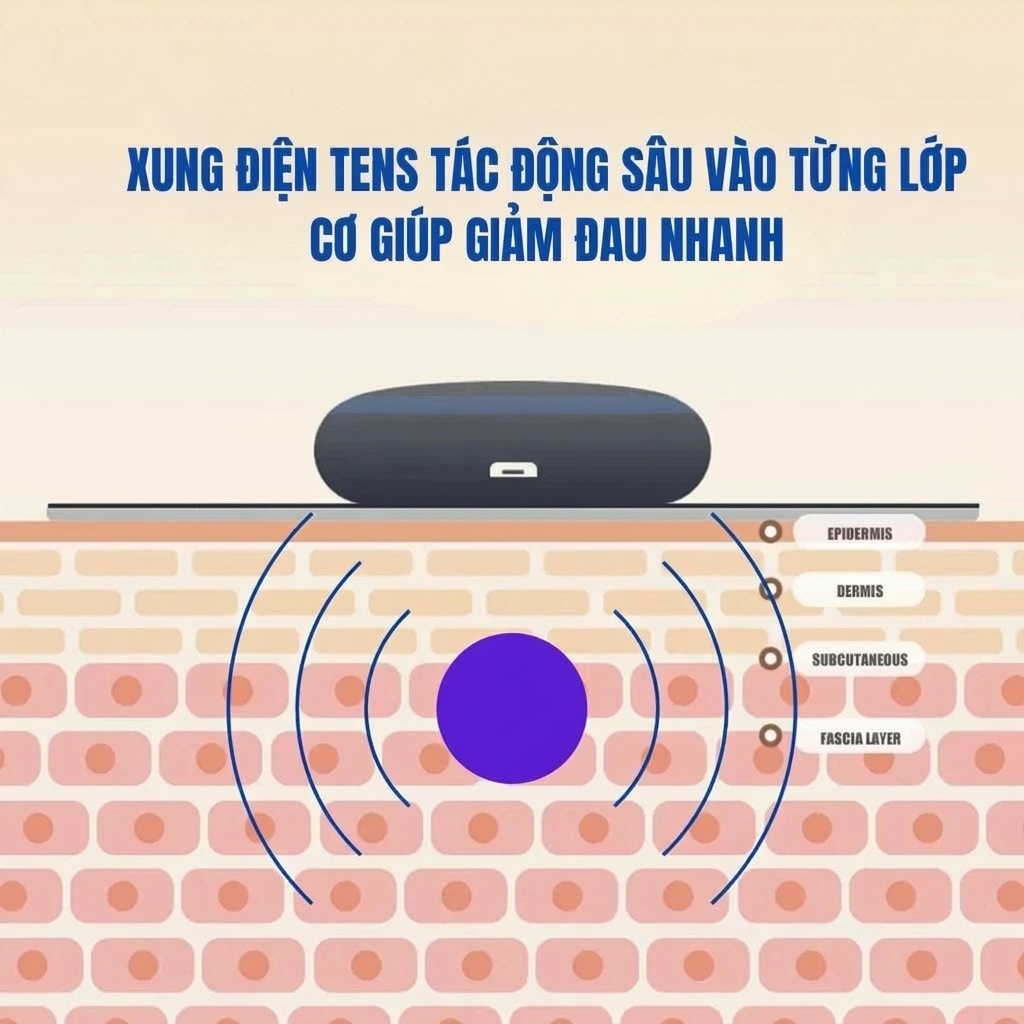 Công nghệ EMS